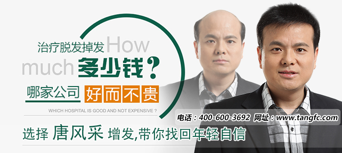 頭頂頭發(fā)稀疏怎么辦？怎樣可以防止脫發(fā)？