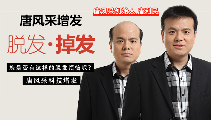 臺州買假發(fā)哪家好？如何挑選適合的假發(fā)？